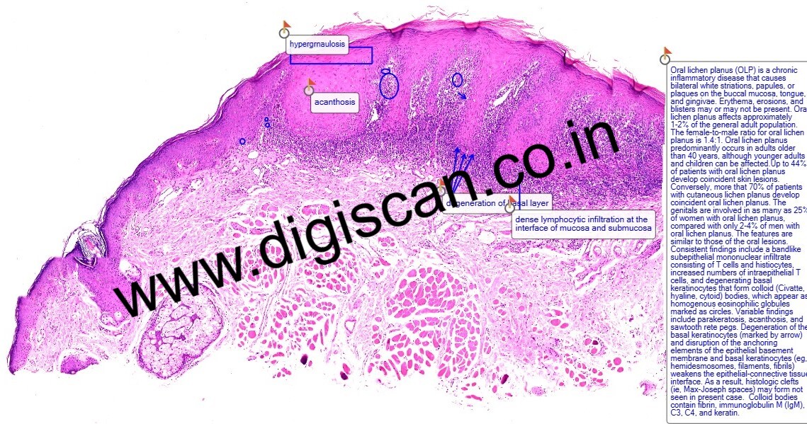 MDS Oral Pathology Exam Cases (Digital Slides & Spot Diagnosis)